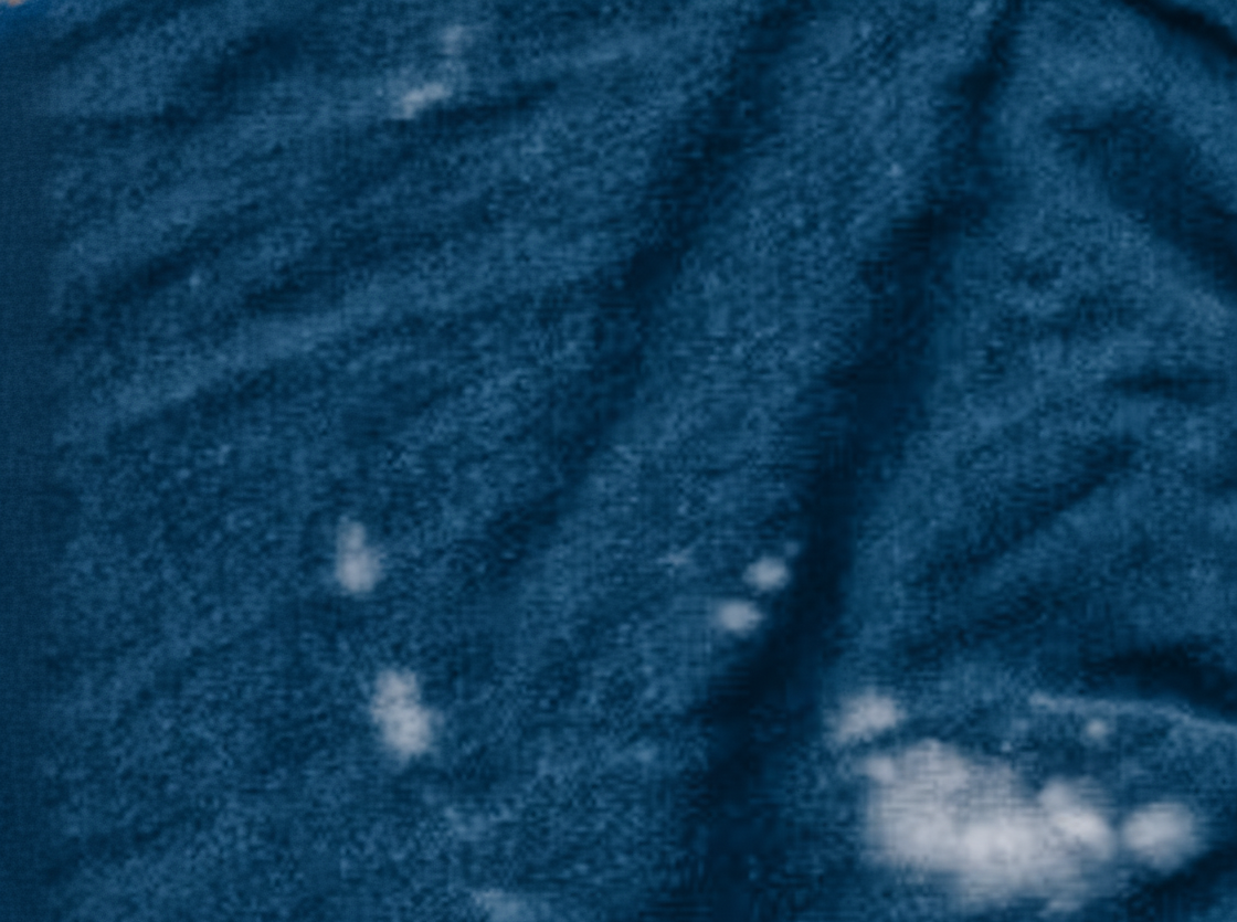 White Spots / Undyed Spots